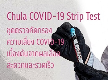 จุฬาลงกรณ์มหาวิทยาลัยพัฒนา Chula
COVID-19 Strip Test